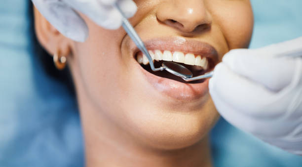 Best Emergency Dental Filling Replacement  in Harristown, IL