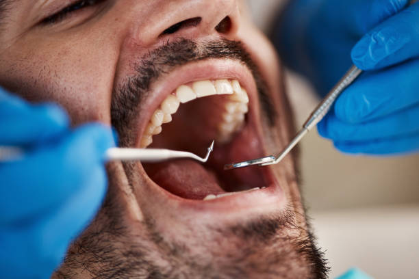 Best Dentist for Severe Toothache  in Harristown, IL